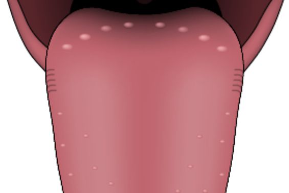 Bild der Zunge
